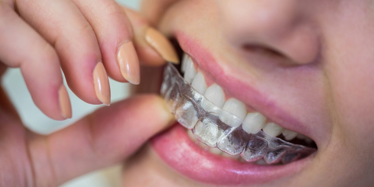 Invisalign vs Conventional Braces: Choosing the Right Orthodontic Treatment